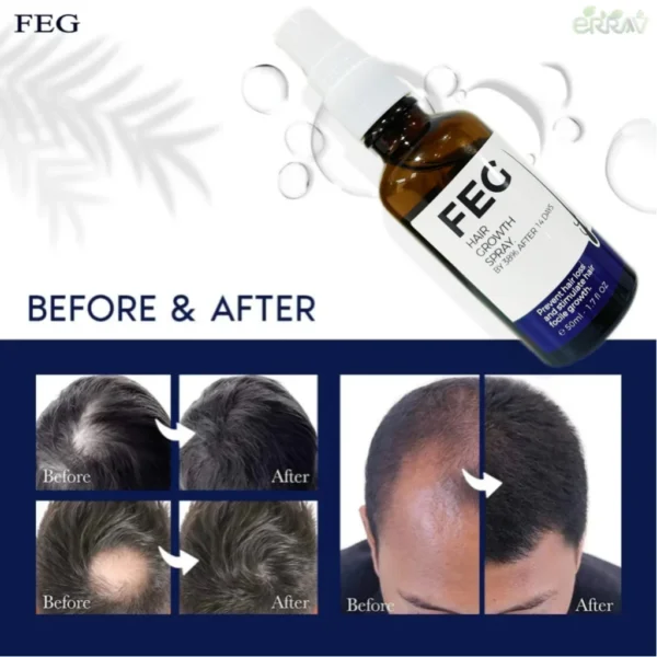 FEG + Hair Growth Spray - Image 2